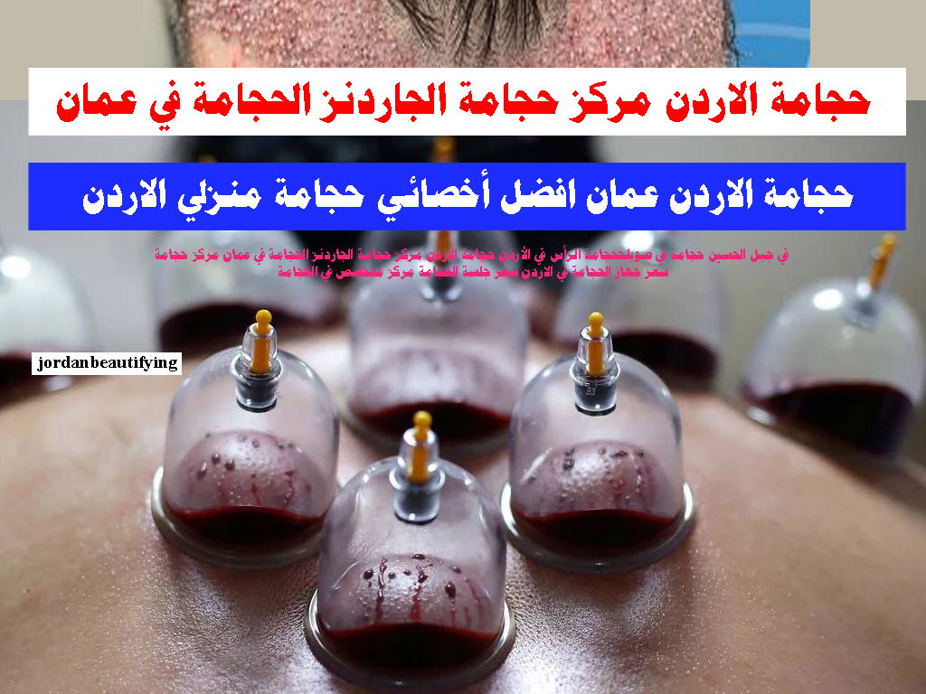 حجامة الاردن مركز حجامة الجاردنز الحجامة في عمان