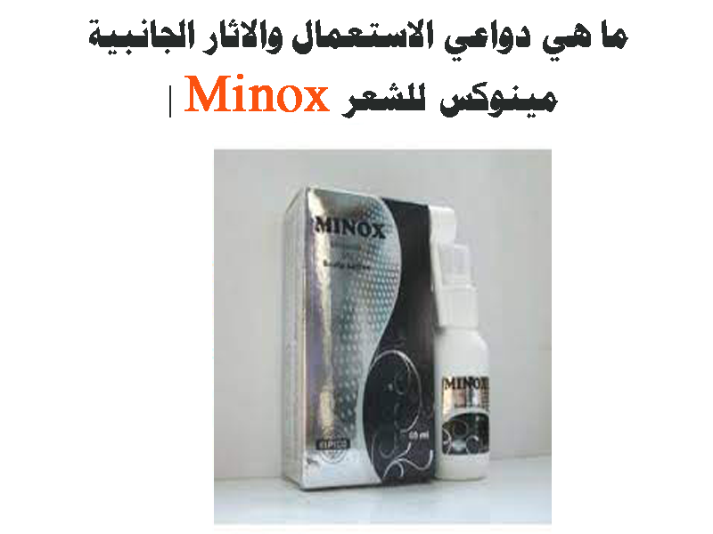 ما هي دواعي الاستعمال والاثار الجانبية Minox مينوكس للشعر